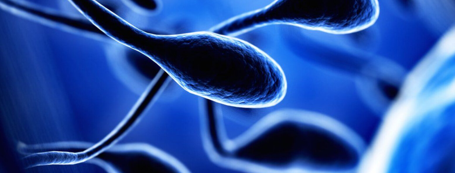 It is Reported That 30-40% Of The Male Infertility is Related With Sperm Dna Fragmantation